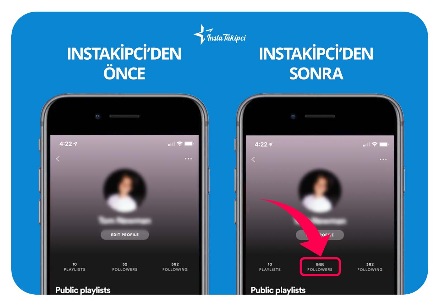 Spotify takipçi önce & sonra